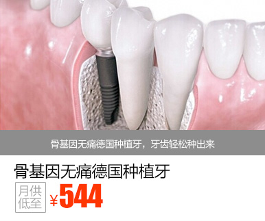 骨基因无痛德国种植牙优惠价多少钱